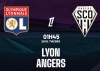 Tip bóng đá 20/09 01:45 Lyon vs Angers: Mồi ngon cho Mãnh sư